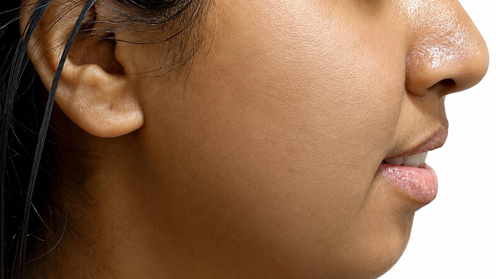 Clear complexion and smooth skin after cosmetology treatment at Murlidhar Skin Clinics