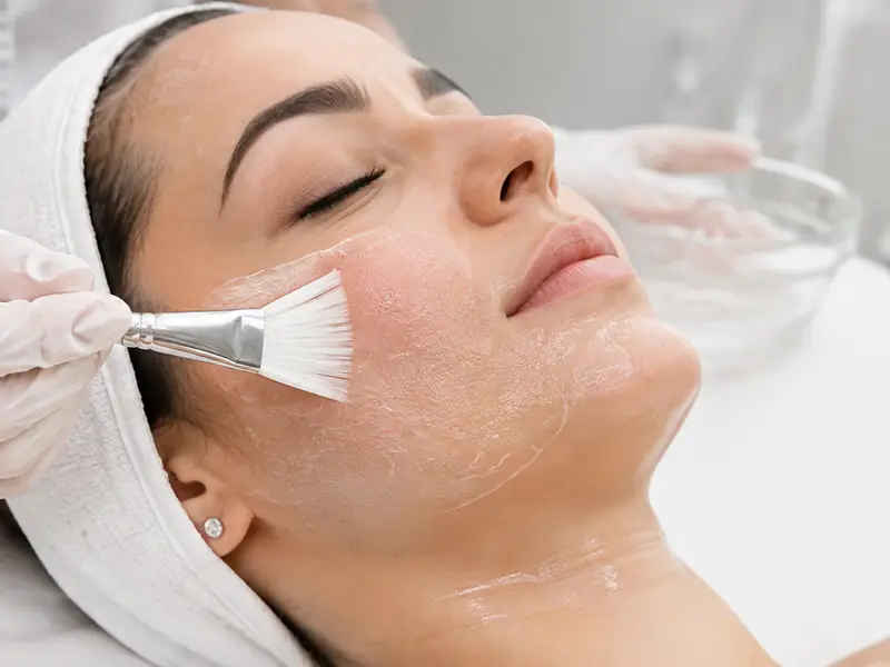 Skin Peeling